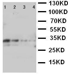 Anti-LTK Rabbit Polyclonal Antibody