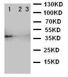 Anti-TRAM2 Rabbit Polyclonal Antibody