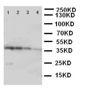 Anti-EIF2AK2 Rabbit Polyclonal Antibody