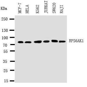 Anti-RSK1 p90 Rabbit Polyclonal Antibody