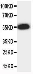 Anti-ANGPTL3 Rabbit Polyclonal Antibody