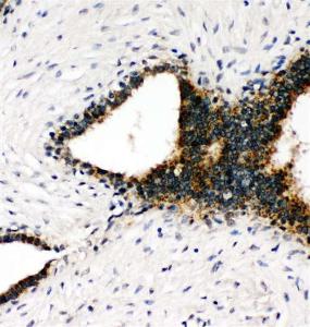 Anti-ANXA8 Rabbit Polyclonal Antibody