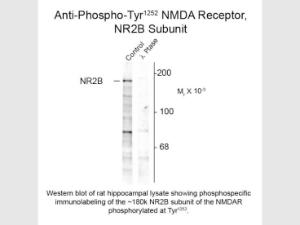 NMDA R2B phospho T1252 AntiBOD