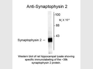 Synaptophysin 2 antibody 100 µl