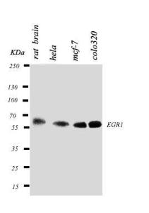 Anti-EGR1 Rabbit Polyclonal Antibody
