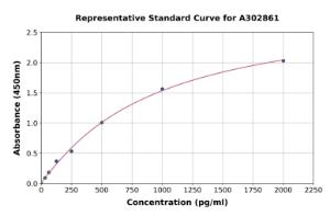 Representative standard curve for Human CMKLR1 ELISA kit (A302861)