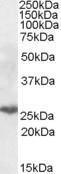 Antibody anti-PSMB10 100 µg