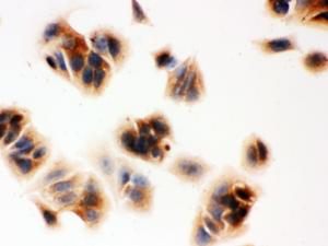 Anti-SERPINB5 Rabbit Polyclonal Antibody