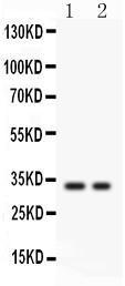 Anti-SFRP2 IgG Polyclonal Antibody