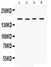 Anti-HKDC1 Rabbit Polyclonal Antibody