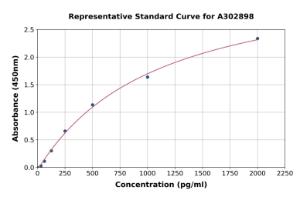 Representative standard curve for Human Malonyl-CoA-acyl Carrier Protein Transacylase Mitochondrial ELISA kit (A302898)