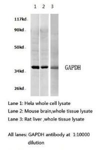 GAPDH primer, Novus Biologicals (NBP1-71650)