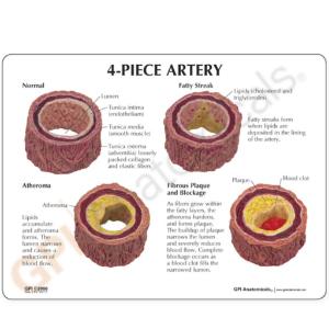 GPI Anatomicals® Artery Model