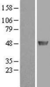 ADE2 Overexpression lysate (adult normal)-western blot-NBP2-11447