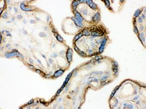 Anti-ANXA3 Rabbit Polyclonal Antibody