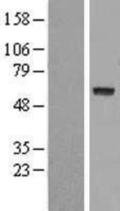 GAS8 Overexpression Lysate (Adult Normal), Novus Biologicals (NBL1-10977)