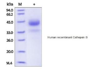 Human recombinant Cathepsin B