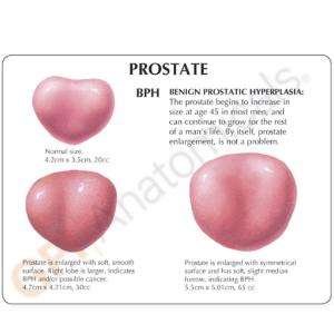 GPI Anatomicals® Male Pelvis with Prostate Model