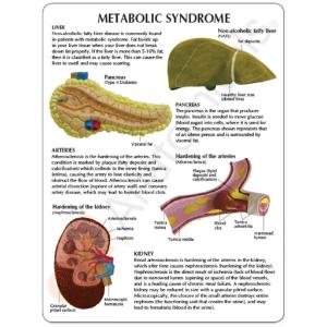 GPI Anatomicals® Metabolic Syndrome Model