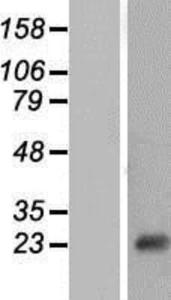 NT5C Lysate (Adult Normal), Novus Biologicals (NBP2-07309)
