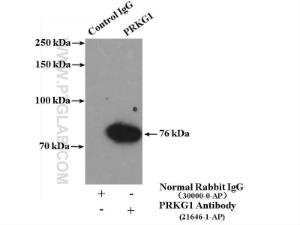 Anti-PRKG1 Rabbit Polyclonal Antibody