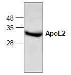 Purity of recombinant human ApoE2 (2 ?g) was analyzed by reduced SDS-PAGE electrophoresis.