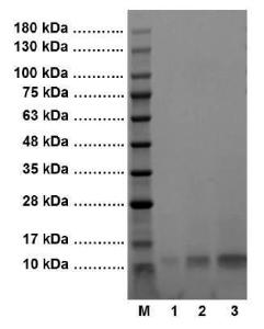 SDS-PAGE (4-20%) of human C5a: M: Protein Marker 1: 1 ?g Human C5a 2: 5 ?g Human C5a 3: 10 ?g Human C5a