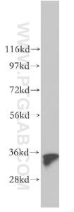 Anti-GGPS1 Rabbit Polyclonal Antibody